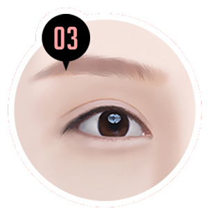 テンミニッツ自然癒着 STEP 03 可愛さ UP 段階 目のイラスト